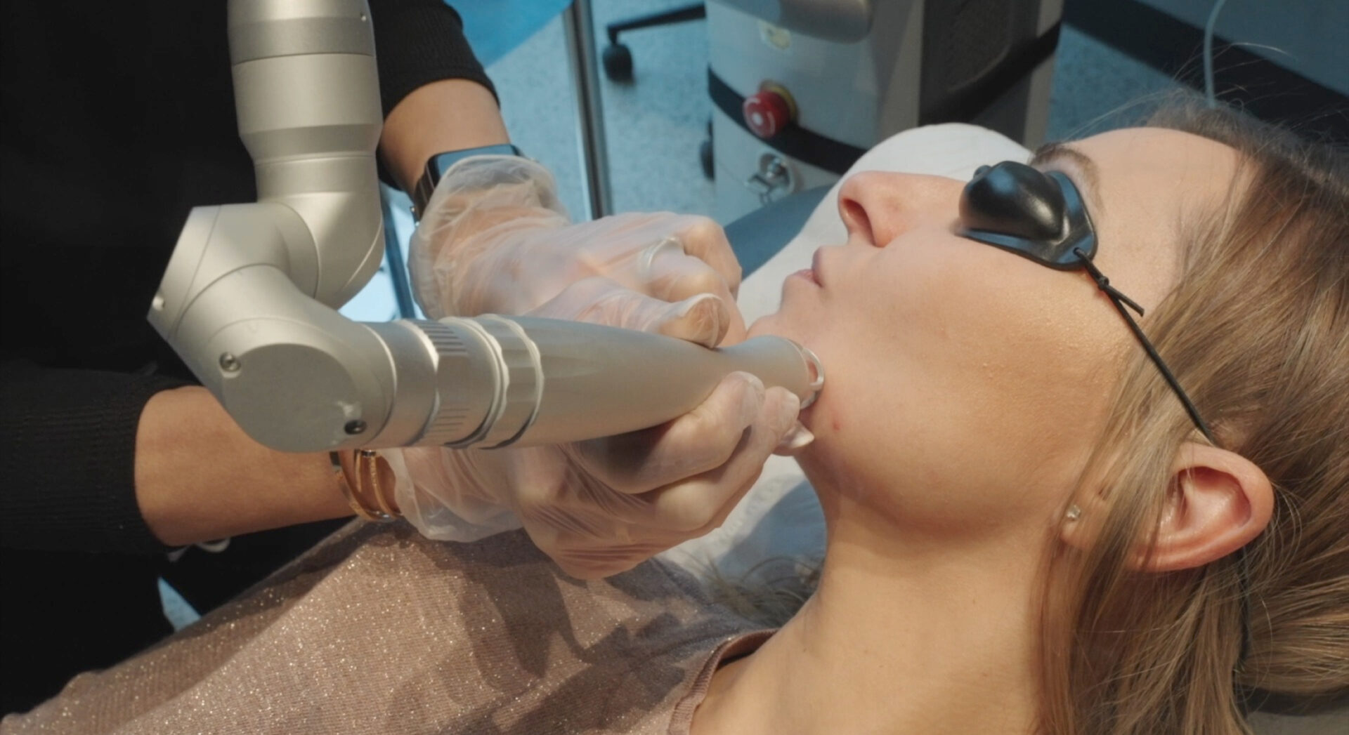 laser mole removal manchester