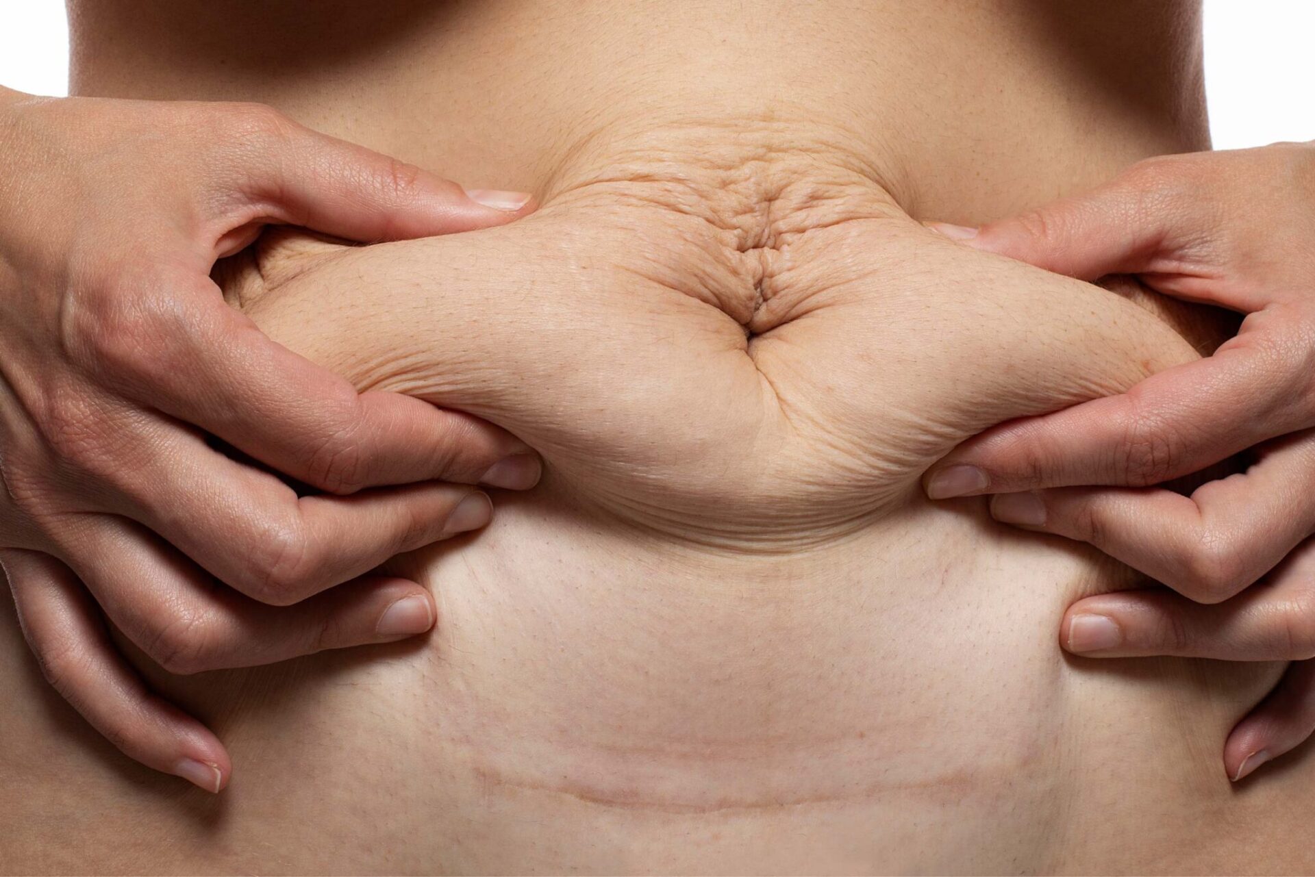 skin tightening after pregancy