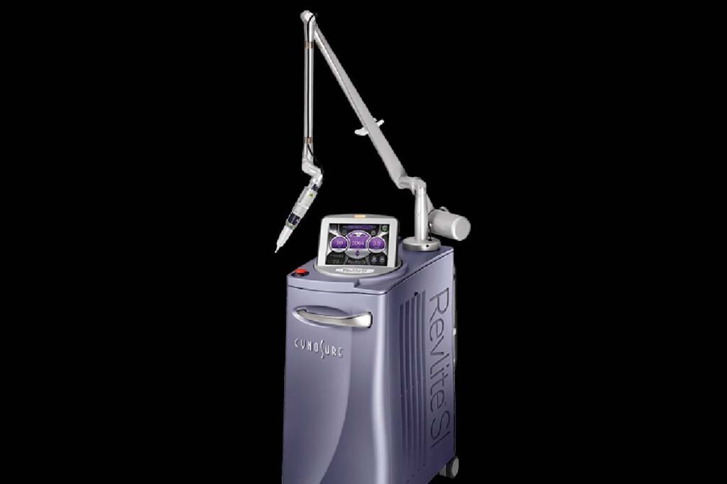 revlite laser Manchester for laser tattoo removal, pigment removal, q switched laser