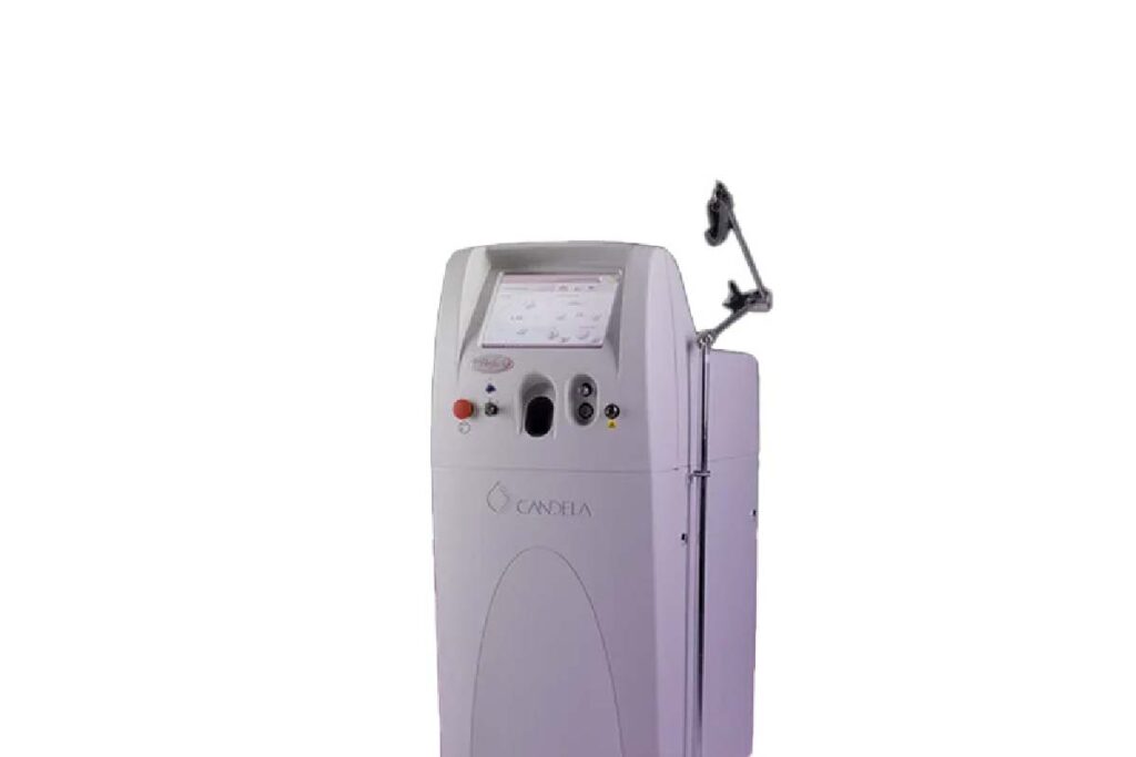 vbeam pdl laser